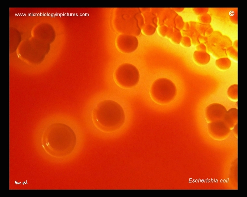 hemolysis